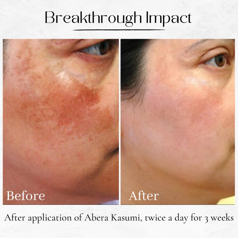ABERA Kasumi Glowing Cream, Melasma Treatment with Niacinamide & HA, Dark Spot Remover For Face, Reduce Fine Lines, Wrinkles, Anti-aging, Red Ginseng Extract, Melasma Cream (0.7 Oz Per Item) - Image 3